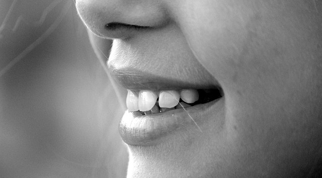 Gummy Smile Nedir, Nasıl Tedavi Edilir?